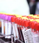 blood_tests