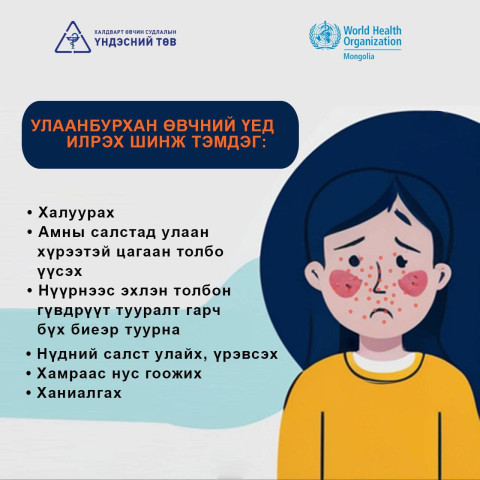 улаанн